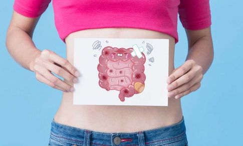 Síndrome del Intestino Irritable: Los Aceites Esenciales que Ayudan